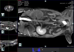Pyohydronefroza pravé ledviny způsobená obstrukcí pravého močovodu urolity – kontrastní CT diagnostika před chirurgickou nefrektomií