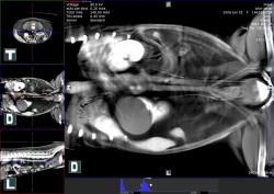 Cystická levá ledvina – kontrastní CT před operací